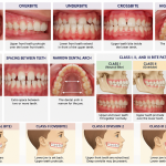 Dental Development and Facial Growth