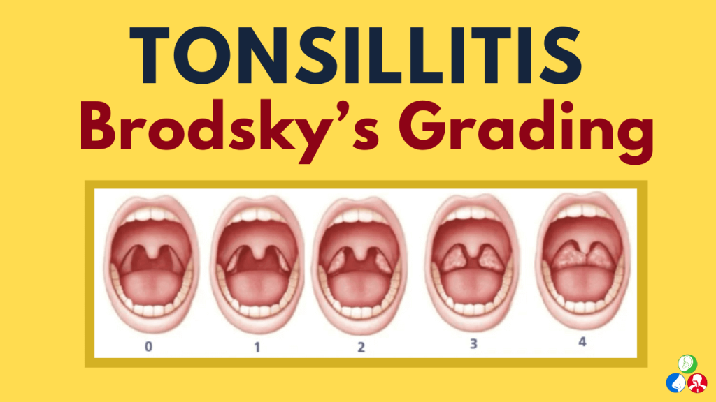Screening for Tonsillitis in Speech Therapy
