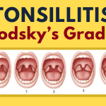 Screening for Tonsillitis in Speech Therapy