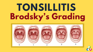 Screening for Tonsillitis in Speech Therapy